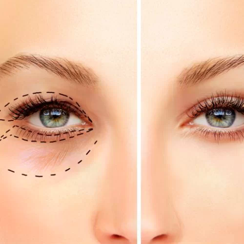 Yılan Yapısı 930022315