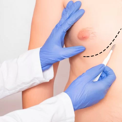 Yılan Yapısı 260168229