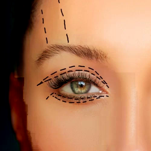 Yılan Yapısı 1524015808