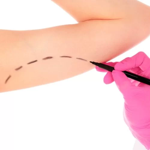 Yılan Yapısı 1964550849