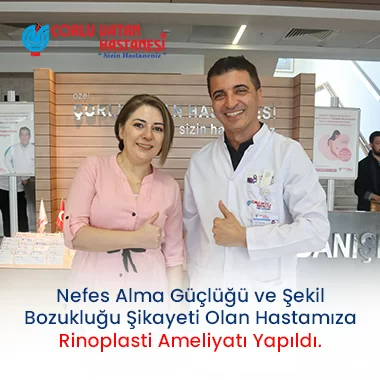 NEFES ALMA GÜÇLÜĞÜ VE ŞEKİL BOZUKLUĞU ŞİKAYETİ OLAN HASTAMIZA RİNOPLASTİ AMELİYATI YAPILDI.