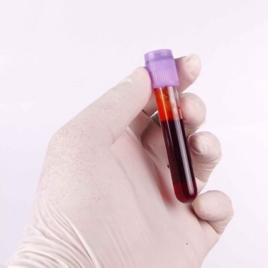 Kan Sayımı ve Pıhtılaşma Paketi