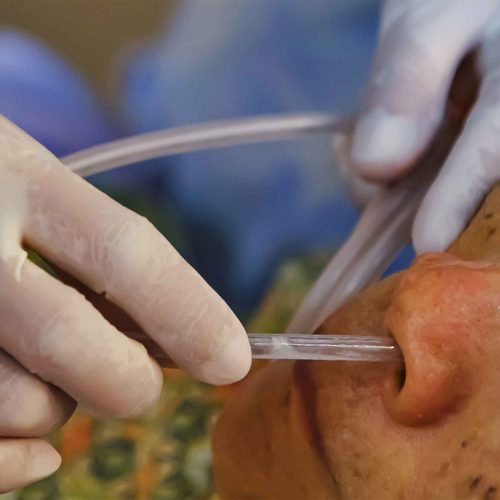 Evde Nazogastrik Sonda Takılması ve Bakımı