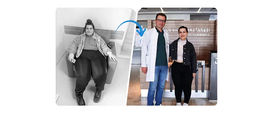 Obezite Cerrahisi ile 6 Ayda 42 Kilo Verdi!