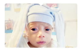 890 Gram Ağırlığında Dünyaya Gelen Mucizemiz