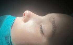 Burun Üzerinde Şişlik, Morluk ve Ağrı Şikayetleri Olan Hastamıza Nazal Redüksiyon (Kapalı Burun Kırığı Ameliyatı) Gerçekleştirildi.