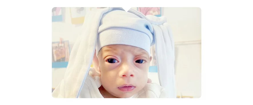 890 Gram Ağırlığında Dünyaya Gelen Mucizemiz