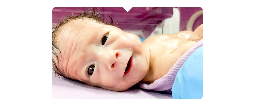 25. Haftasında Doğan Minik Mucizemiz Sağlıkla Taburcu Oldu