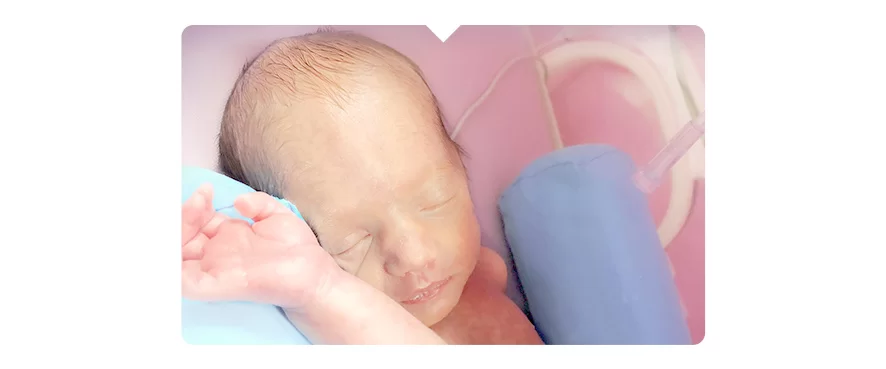 31 Haftalık Doğan İkizler Sağlıkla Taburcu Oldular