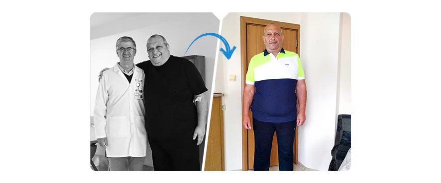 Bulgaristan’dan Gelen Hastamız 5 Ayda 41 Kilo Verdi