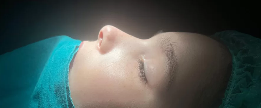 Burun Üzerinde Şişlik, Morluk ve Ağrı Şikayetleri Olan Hastamıza Nazal Redüksiyon (Kapalı Burun Kırığı Ameliyatı) Gerçekleştirildi.