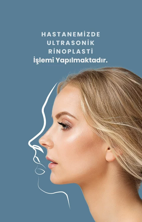 Rinoplasti