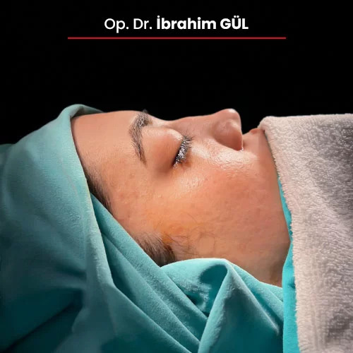 Öncesi Sonrası 1450053484