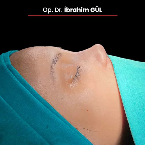 Öncesi Sonrası 751041890