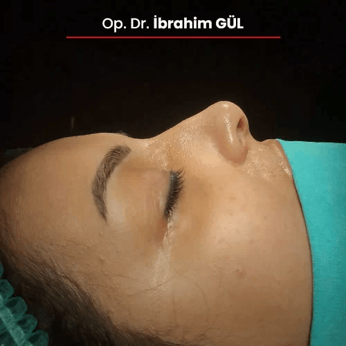 Öncesi Sonrası 812377066