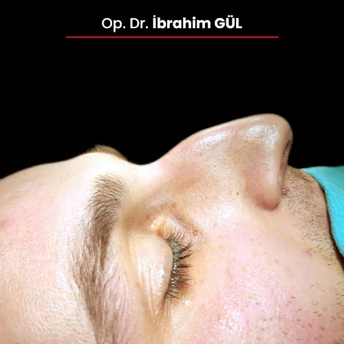 Öncesi Sonrası 2067463207