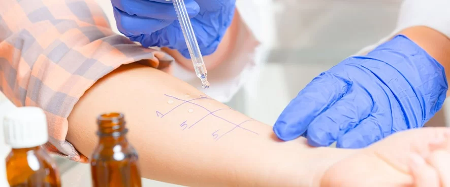 Alerji Tanısı için Akılcı Çözüm Alex Allerji Testi