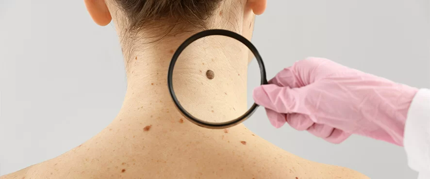 Benlerin Sağlık İçin Önemi ve İzlenmesi