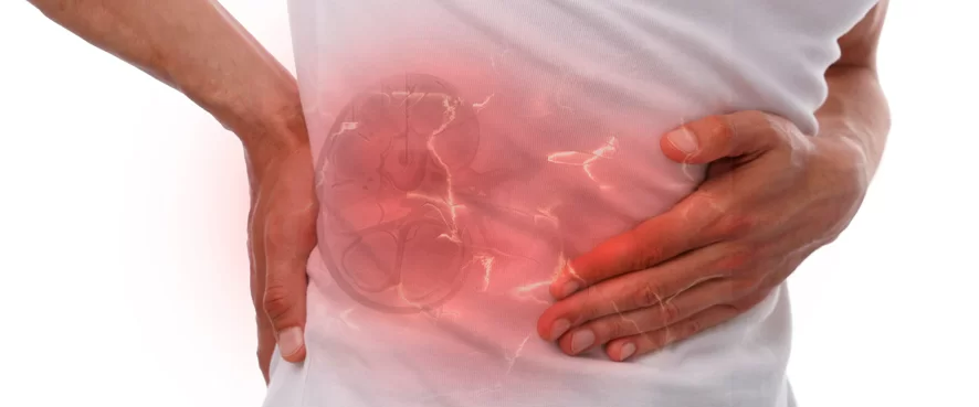 Böbrek Taşları Hakkında A’dan Z’ye Her Şey