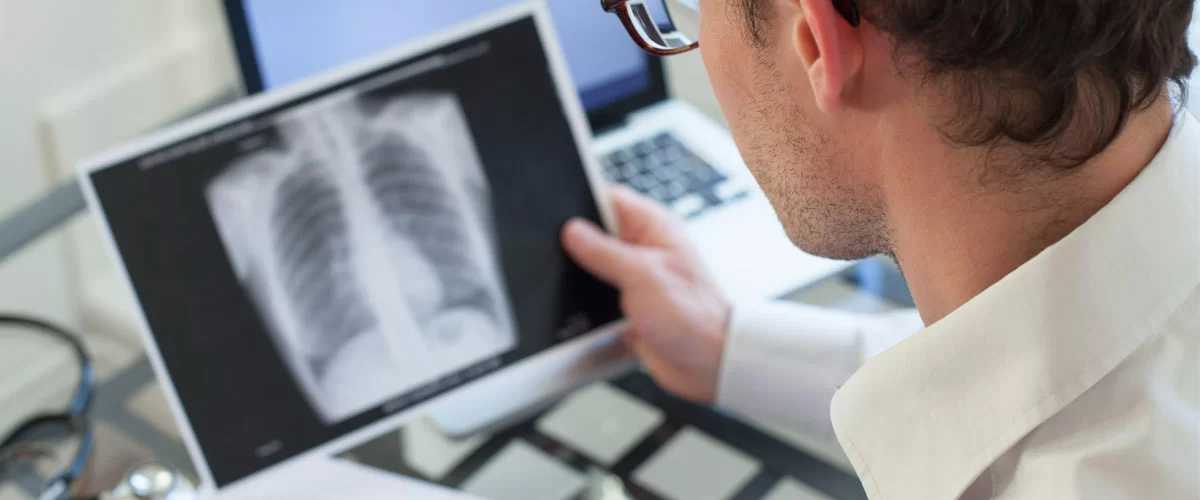 COVID-19 Pandemi Sürecinde Çıkan Gizli Hastalıklar