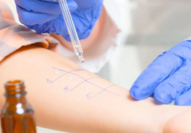 Alerji Tanısı için Akılcı Çözüm Alex Allerji Testi