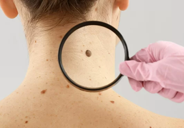 Benlerin Sağlık İçin Önemi ve İzlenmesi