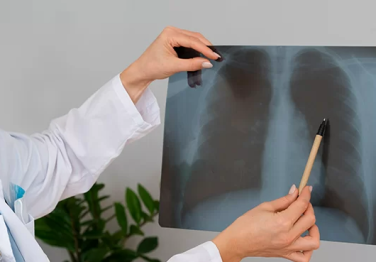 Bronşit: Belirtiler, Nedenler ve Tedavi Yöntemleri