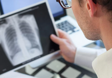 COVID-19 Pandemi Sürecinde Çıkan Gizli Hastalıklar