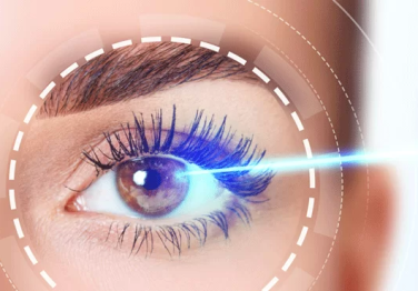 Excimer Lazer Nedir?