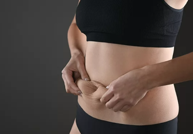 Obezite Cerrahisi ve Ameliyat Çeşitleri