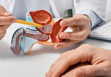 Prostat Kanseri Belirtileri Nelerdir? Evreleri ve Tedavisi