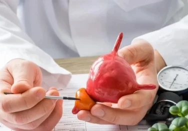 Prostat Büyümesinde THULEP (Thulium Lazer Enükleasyonu) Tedavi Yöntemi