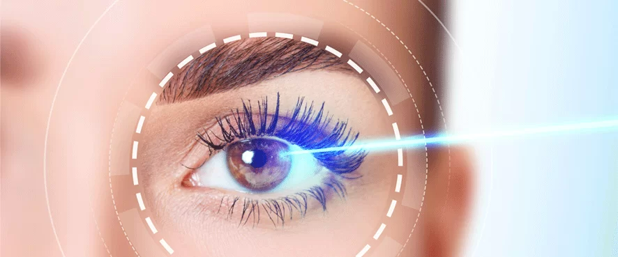 Excimer Lazer Nedir?