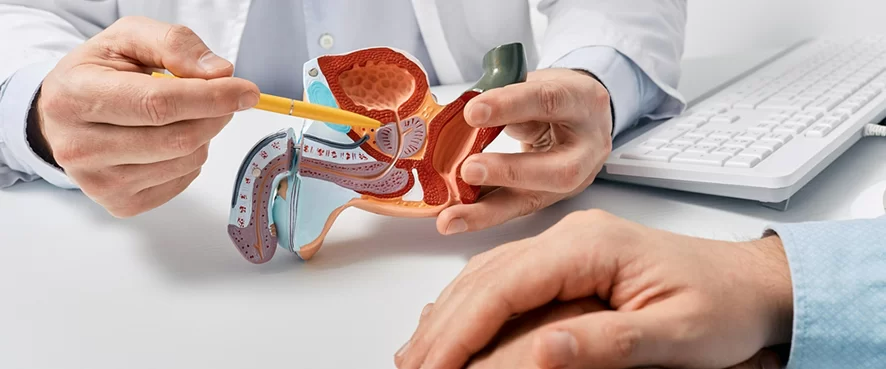 Prostat Kanseri Belirtileri Nelerdir? Evreleri ve Tedavisi