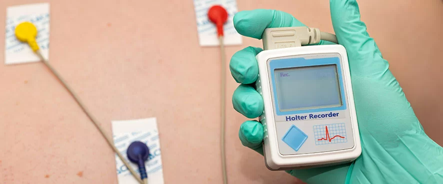 Ritim Holter Testi: Kalp Ritim Bozukluklarını İzleme ve Değerlendirme
