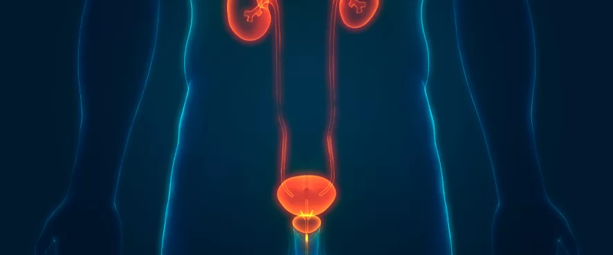 Ürolojik Kanser Çeşitleri Nelerdir? Ürolojik Kanserler Nasıl Teşhis Edilir?