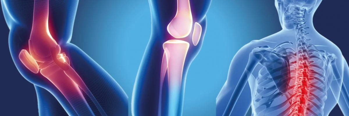 Ortopedi ve Travmatoloji