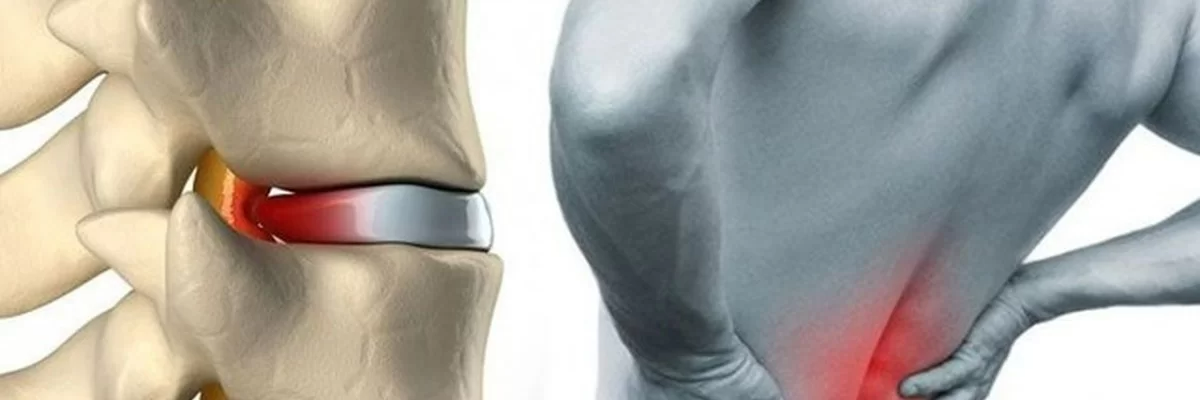 Beyin ve Sinir Cerrahi