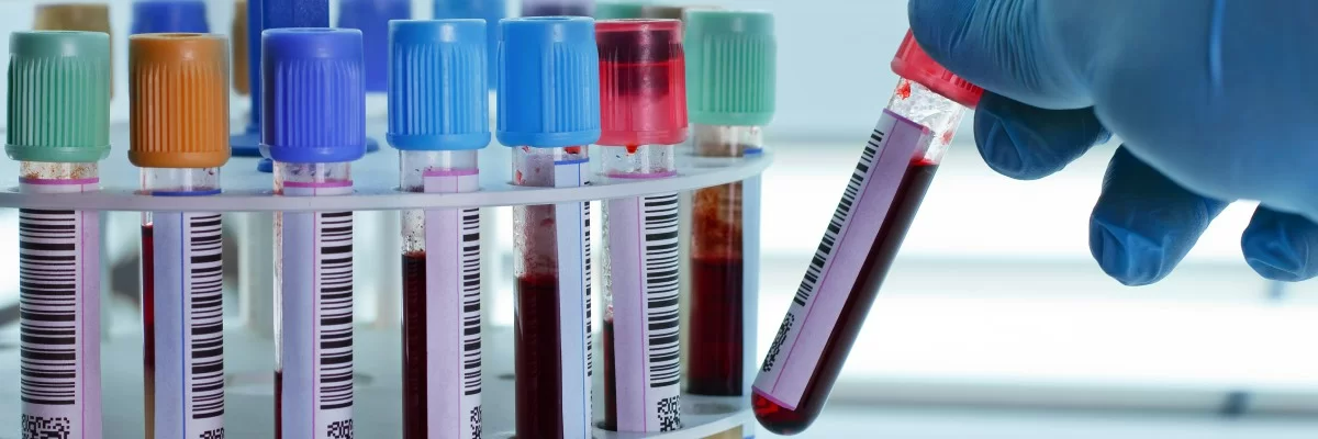 Biyokimya Laboratuvarı