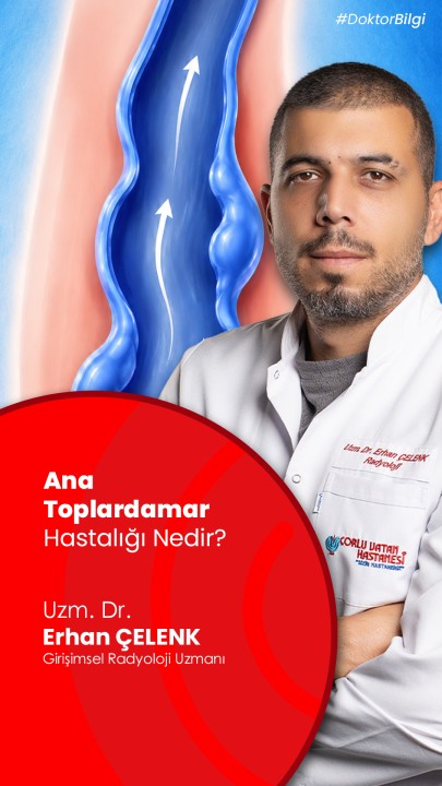 Akşam olunca bacaklarınız ağırlaşıyor mu? Sebebi bu olabilir.
